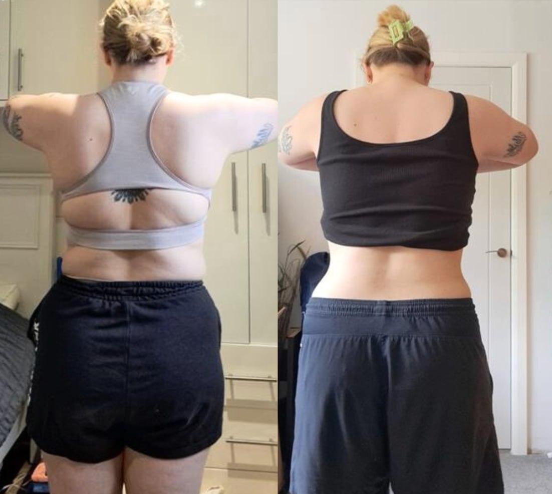 Catherine before and after