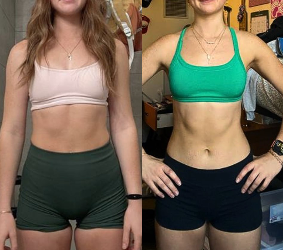 Emmy before and after